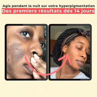 Masque de nuit anti tâches au curcuma